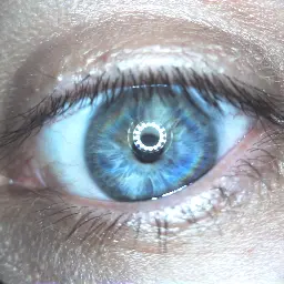 Eye during external eye exam