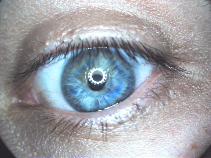 Upclose view of an eye captured with the DE605