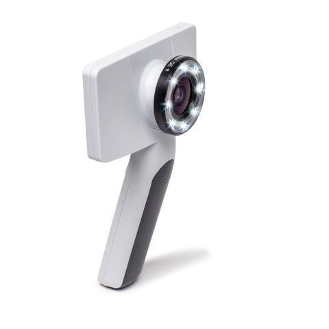 RCS-100 with General Exam Lens attached. RCS-100 with General Exam Lens attached.