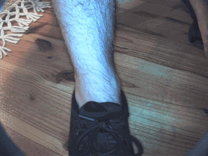 Ankle captured with the DE605